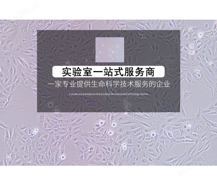 4.jpg HFF-1人包皮成纤维细胞细胞系